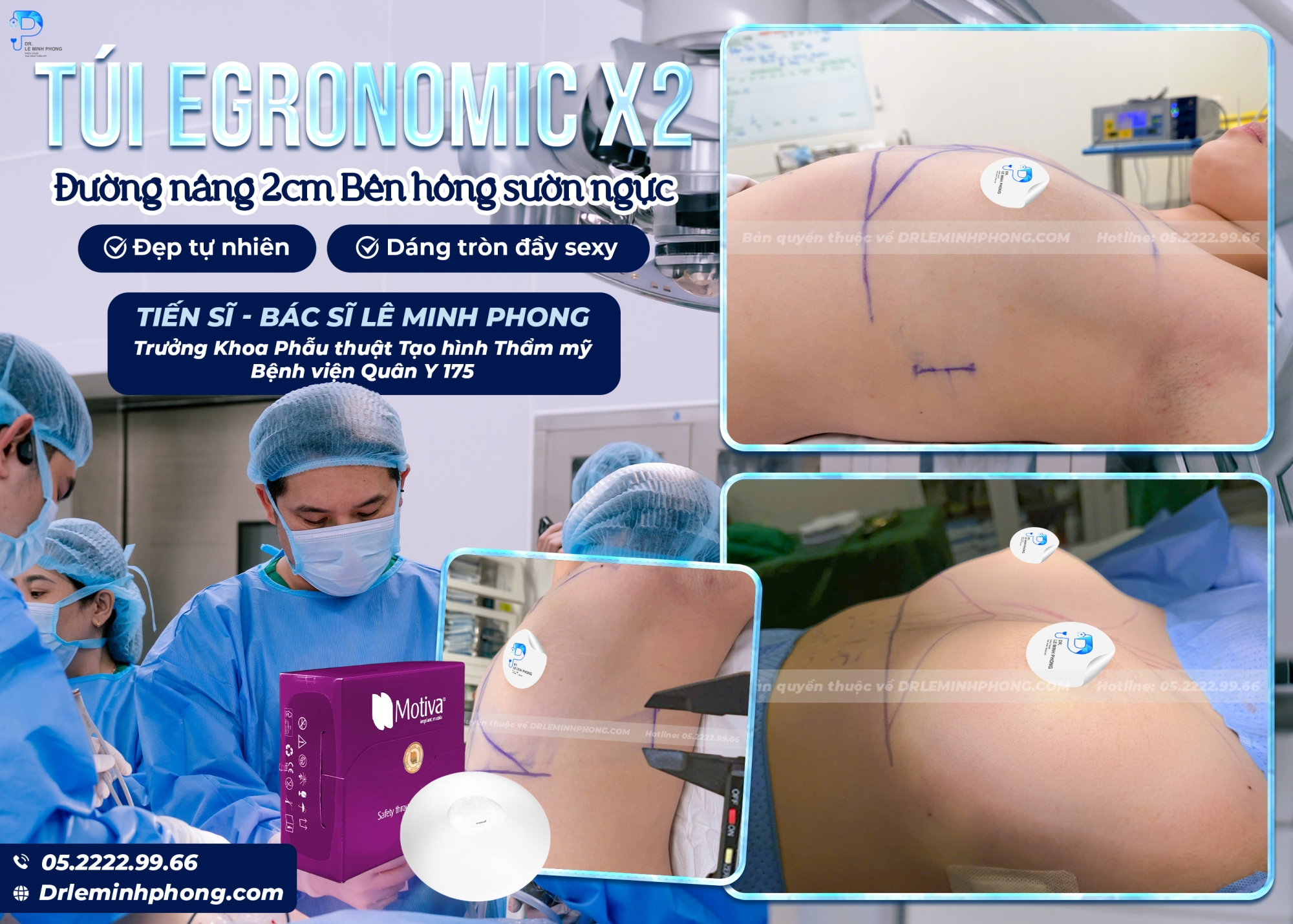 Đường nâng 2cm - Túi ngực Ergonomic X2