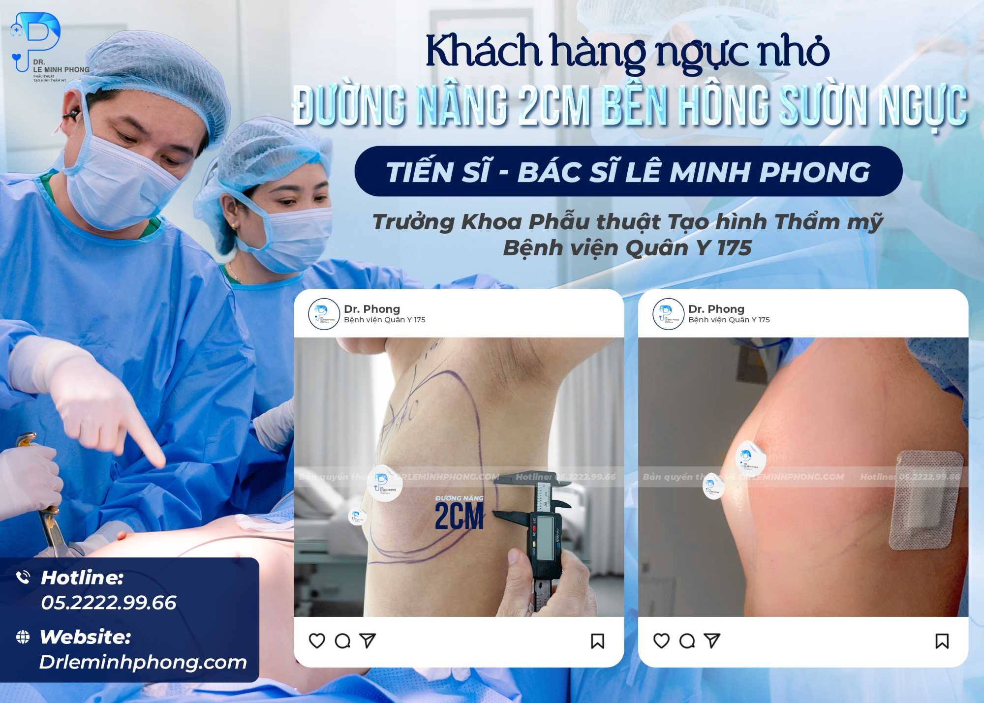 Đường mổ chỉ 2cm, nâng tầm vòng 1 – Thực hiện Dr Phong