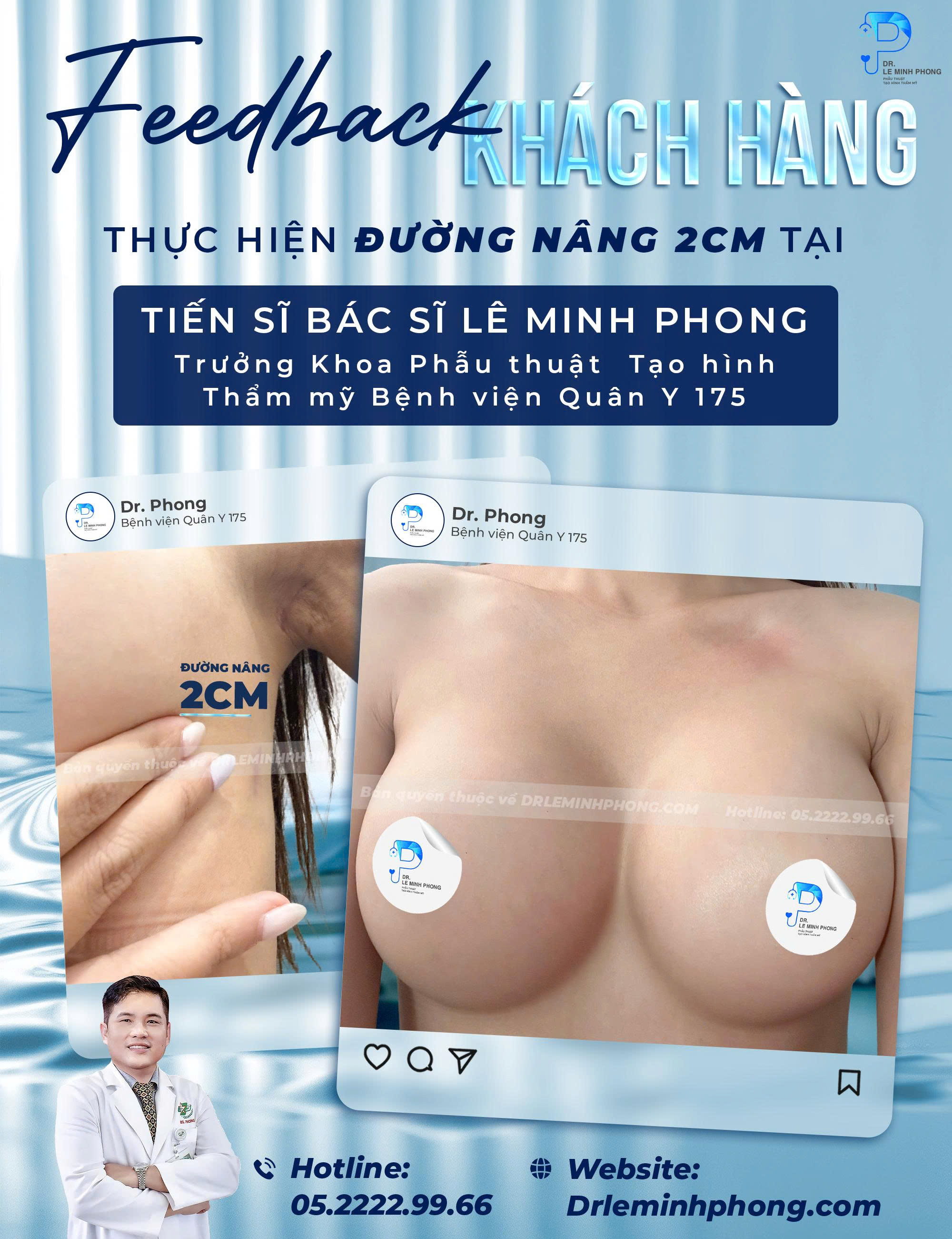 Túi Ergonomic x2 Feedback Khách Hàng Sau Nâng Ngực – Đường Nâng Chỉ 2cm