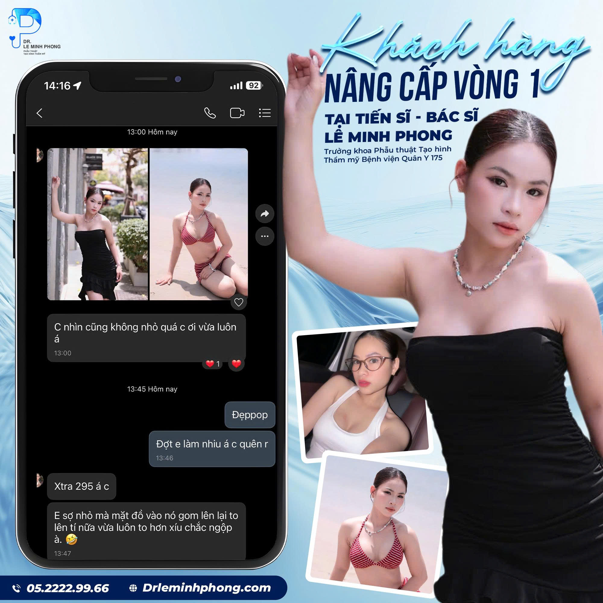 Feedback Túi Mentor Extra size 295cc. Khách Hàng Sau 1 Tháng Nâng Ngực – Đường Nâng Chỉ 2cm.