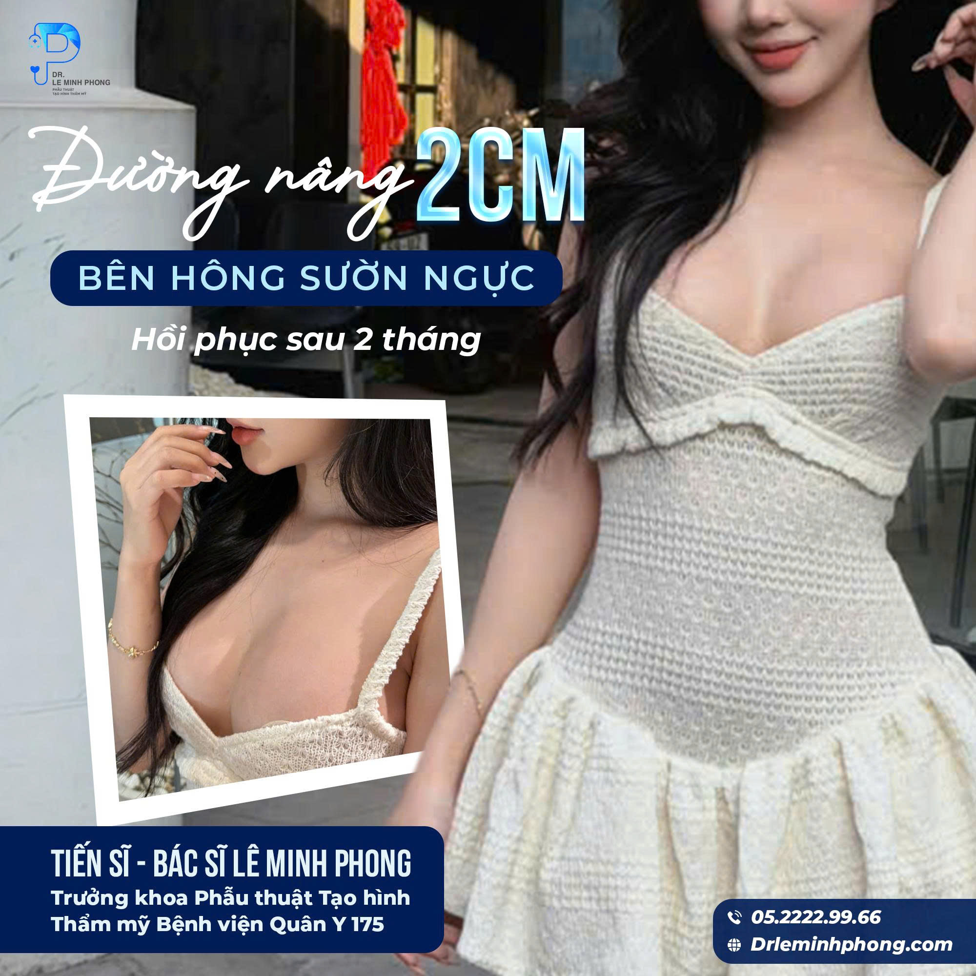 Feedback Sau 2 Tháng Nâng Ngực Đường 2cm Khiến Khách Hàng Hài Lòng