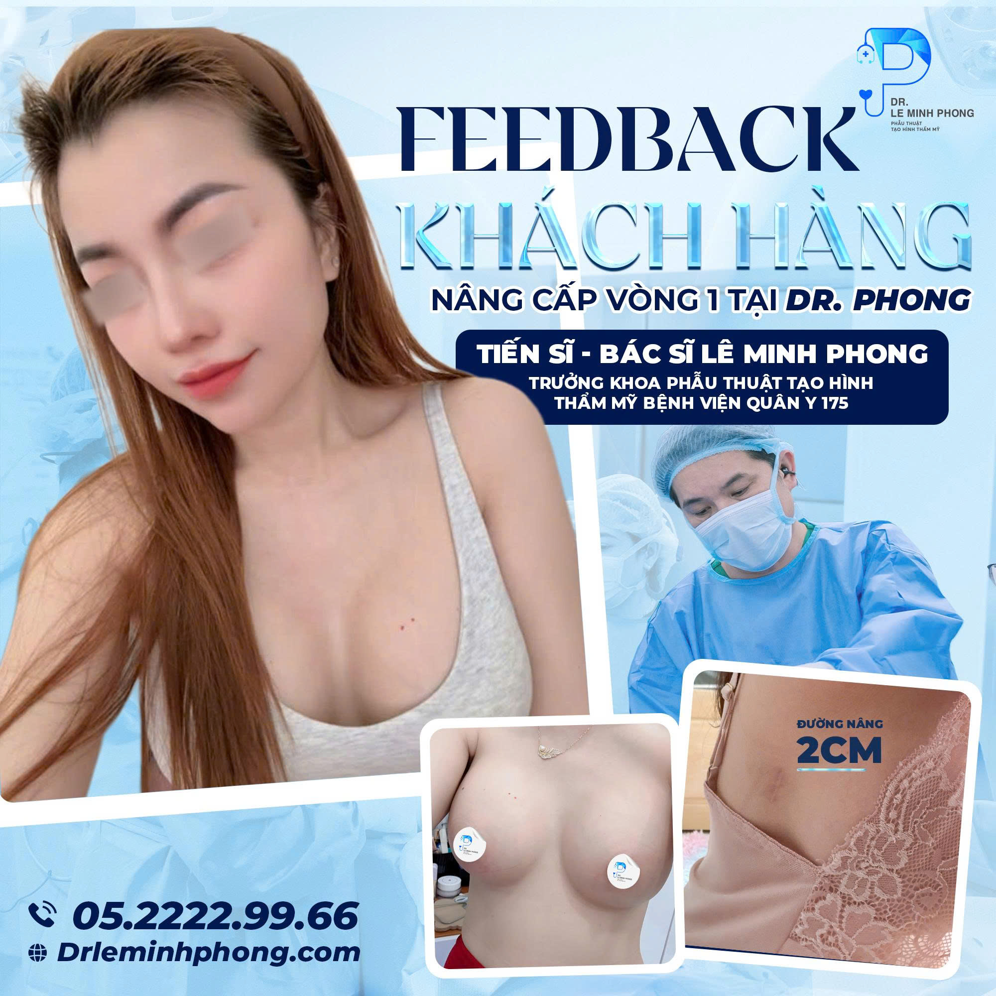 Feedback túi Ergonomic của Khách Hàng Sau Nâng Ngực Đường 2cm 