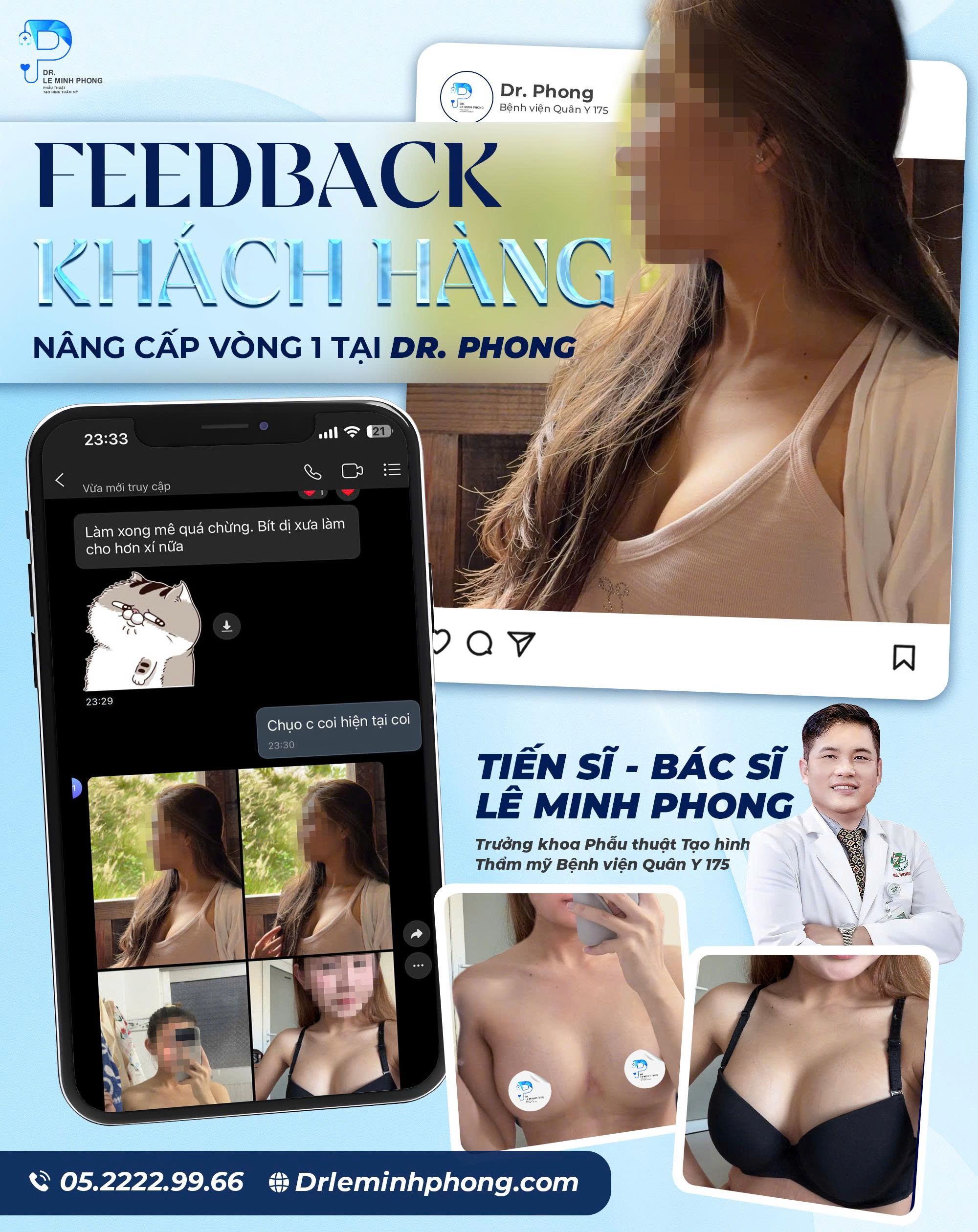 Feedback Feedback Khách Hàng Sau Nâng Ngực Đường 2cm – Trải Nghiệm Nhẹ Nhàng Hơn Mong Đợi