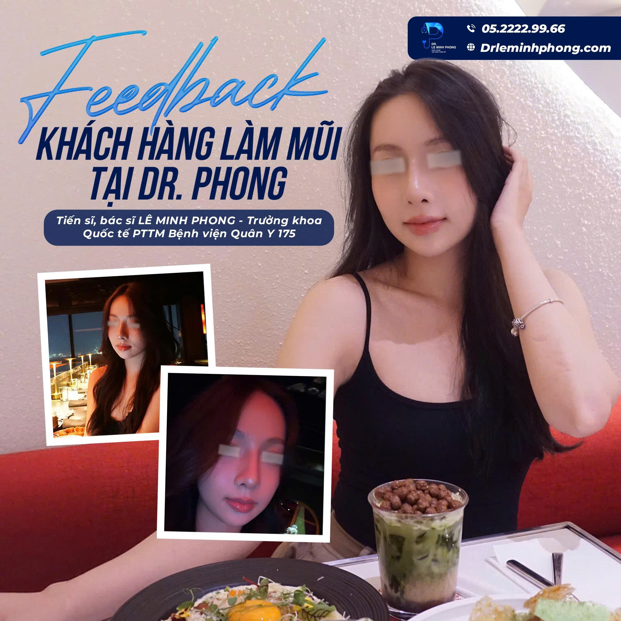 Feedback Thực Tế Của Khách Hàng Sau Nâng Mũi Tại TS.BS Lê Minh Phong