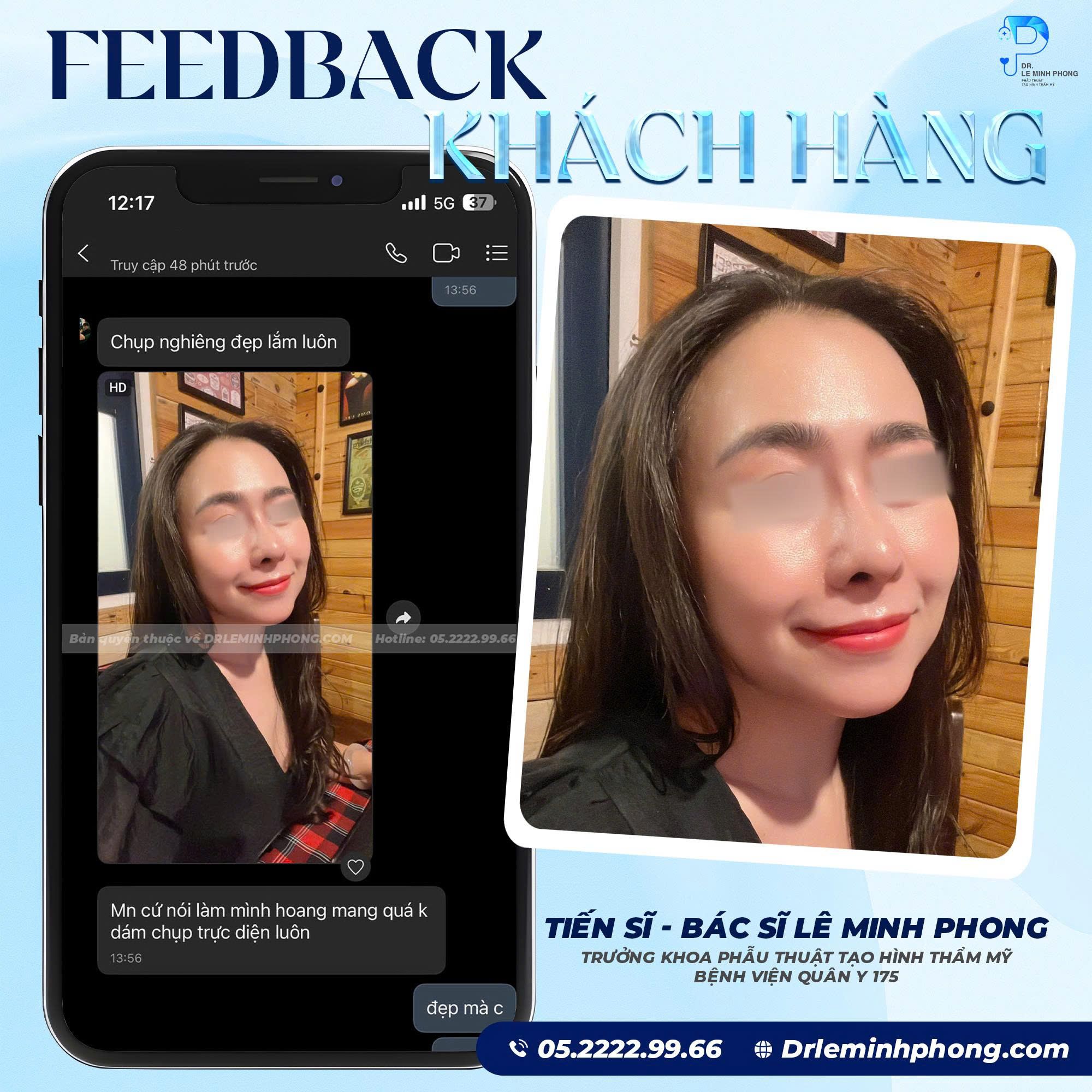 Feedback Nâng Mũi: Đẹp Tự Nhiên, Tự Tin Hơn Mỗi Ngày Tại TS.BS Lê Minh Phong